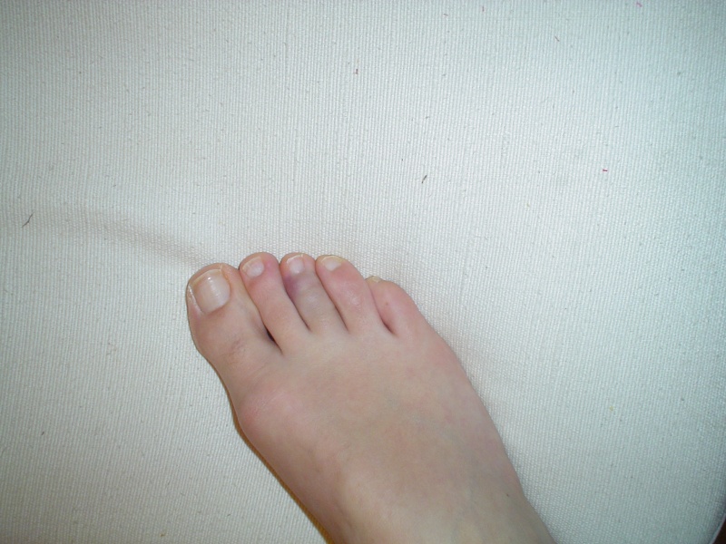 http://i66.servimg.com/u/f66/12/36/05/07/dsc00350.jpg
